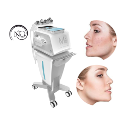 NG M6 - oczyszczanie wodorowe 2