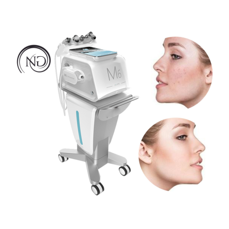 NG M6 - oczyszczanie wodorowe